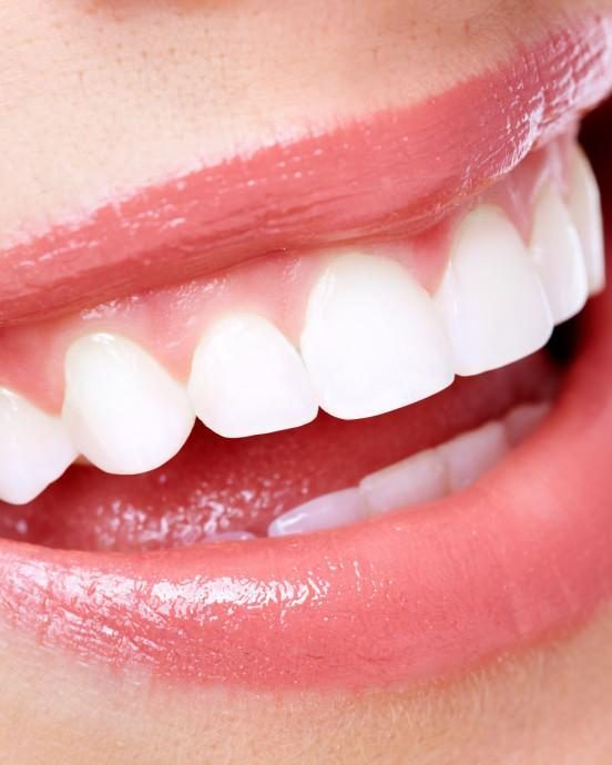 Teeth Cleaning (Scaling & Polishing)